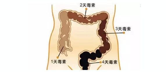 肠道内竟然能积存6.5kg的垃圾,你的肠子里有多少呢?