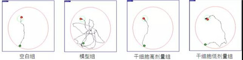 康婷集团《探索科学，乐享健康》栏目：干细胞治疗神经退行性疾病的新希望